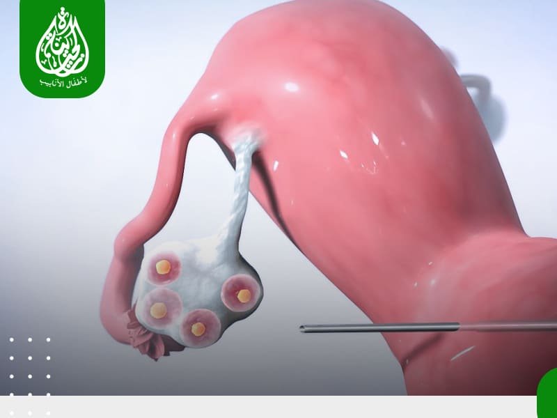 الرئيسية 11 سحب البويضات